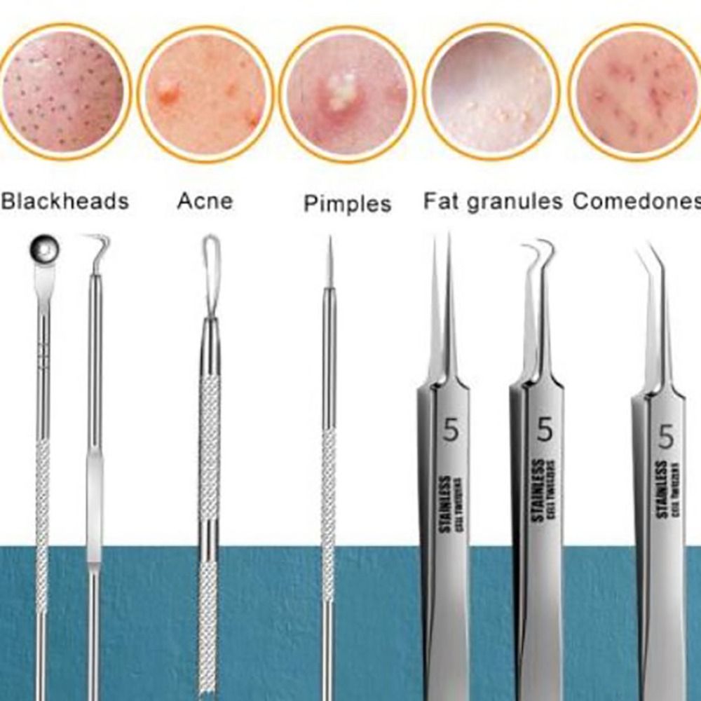 acne needle tool set for blackhead and pimple removal